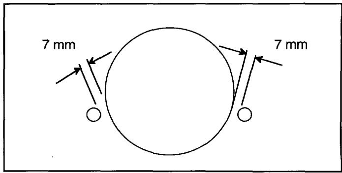 HUSQVARNA 6-23 - Réglage des guides-courroies - 3