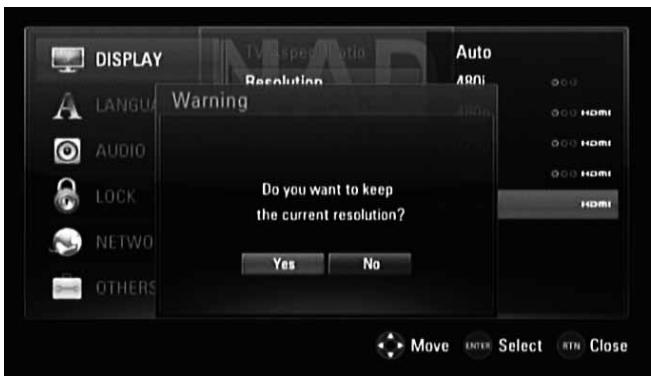 NAD T557 - Connexion HDMI OUT (SORTIE HDMI) - 3