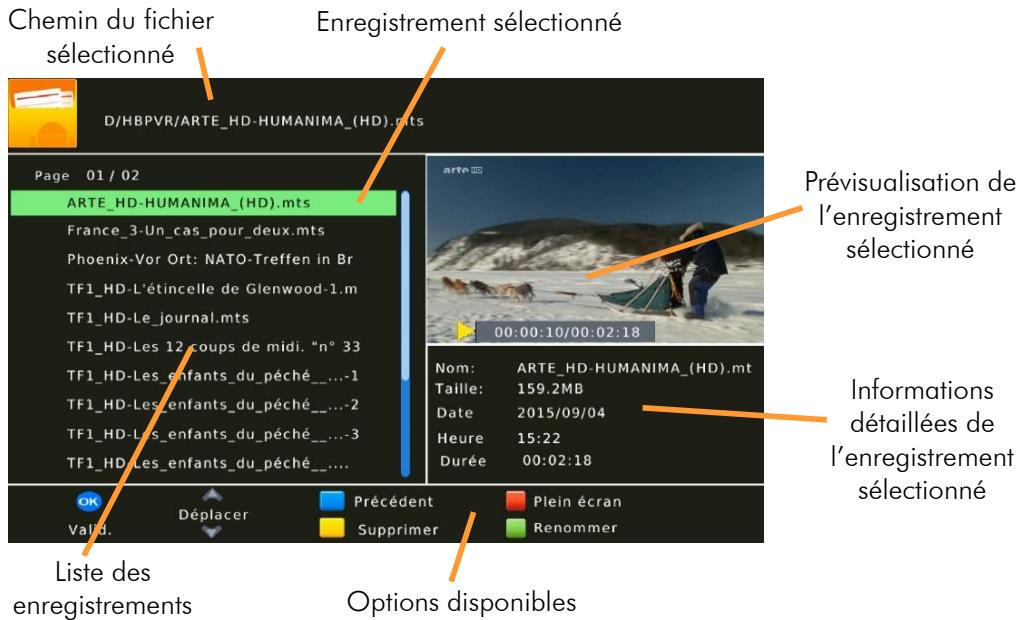 CGV ETIMO STL 2 - Lecture d'un enregistrement - 1