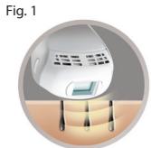 REMINGTON ILIGHT IPL6780 - DECOUVRIR L'i-LIGHT - 1
