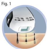 REMINGTON 6250 - Decouvrilight - 1