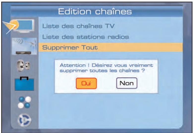 SERVIMAT TNT65HDU - LISTE Des chaines (tout supprimer) - 2