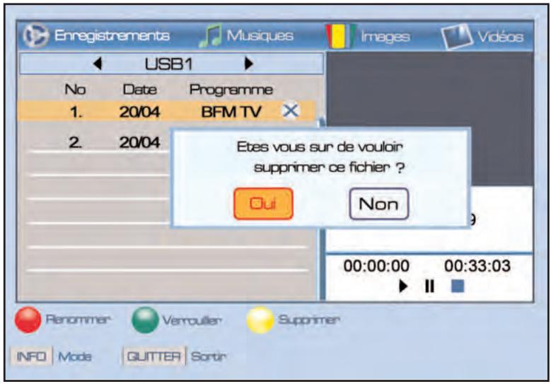 SERVIMAT TNT65HDU - Lecteur multimedia (mode enregistrement, supprimer un enregistrement) - 1