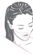 REMINGTON I LIGHT IPL6750 - \* Traitement facial (uniquement pour les femmes) - 1