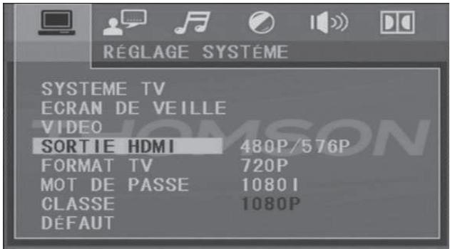 THOMSON DVD120H - Sortiehdmi - 1