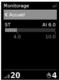 ResMed AirCurve 10 ST-A - Démarrage du traitement - 1