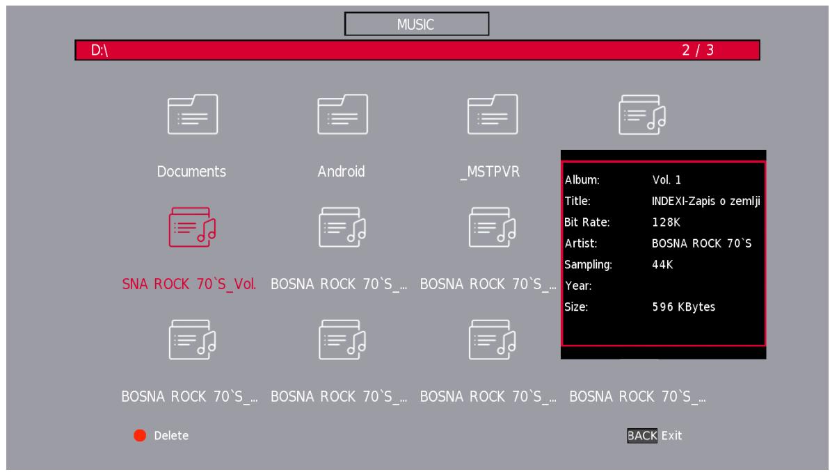 THOMSON 24HD2S13 - Menu Musique - 2