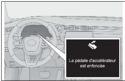 LEXUS LBX AY10 (2023) - Suppression de l'accélération à vitesse faible - 1