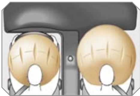 PEUGEOT 308 - Airbags frontaux - 1