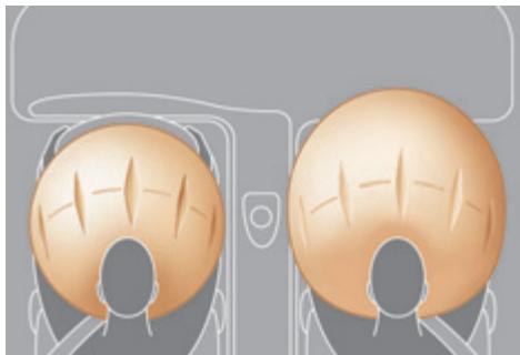 PEUGEOT 3008 - Airbags frontaux - 1
