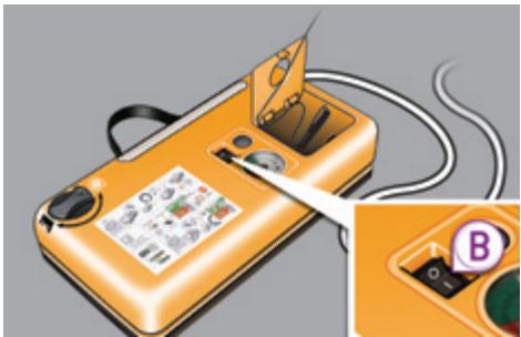 PEUGEOT 3008 - Colmatage - 7