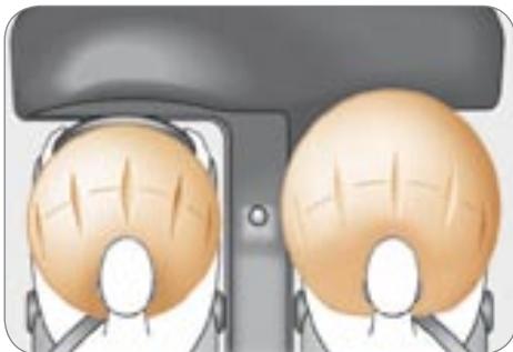 PEUGEOT 4007 - Airbags frontaux - 1