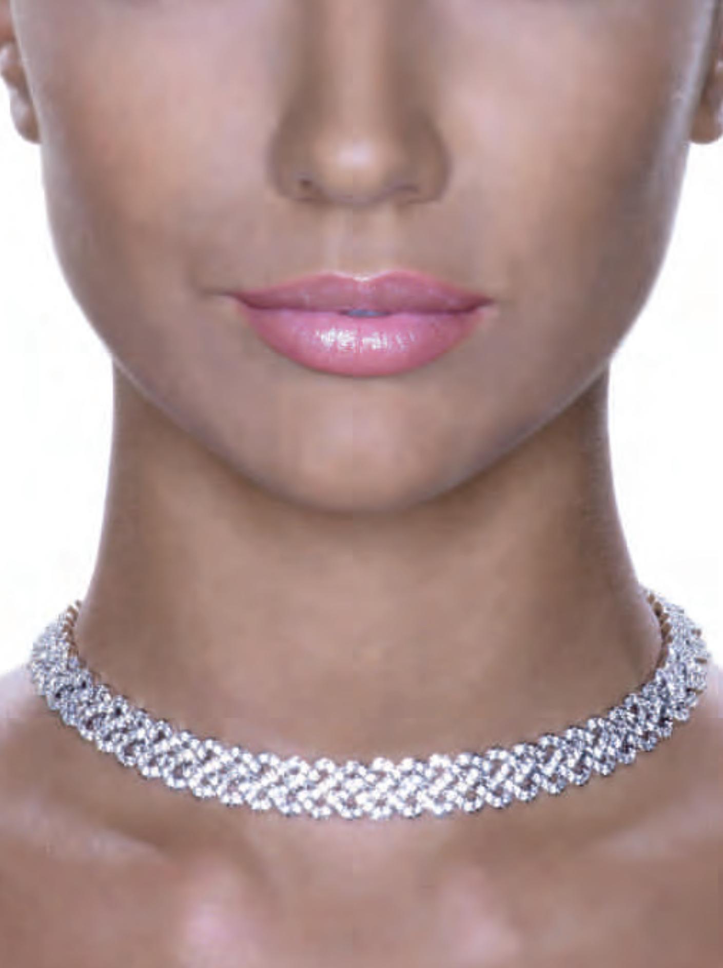 FORD FIESTA - Direction assistée électrique (EPAS) - 4