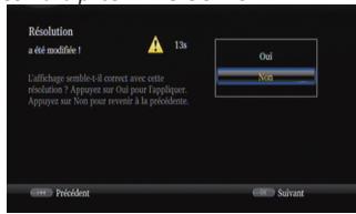 TOSHIBA BDX 4400 - Appuyez sur OK pour appeler les paramètres de résolution. - 2