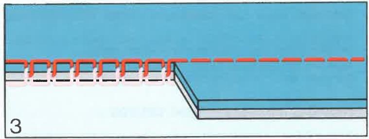 ELNA 7000 - Tension inférieure - 2
