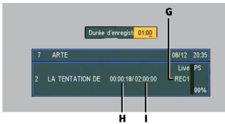 SAGEMCOM DT 570 PB - Enregistrement spontané sur USB - 1