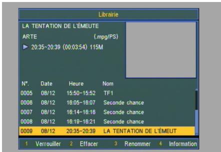 SAGEMCOM DT 570 PB - Visionner les enregistrements - 1