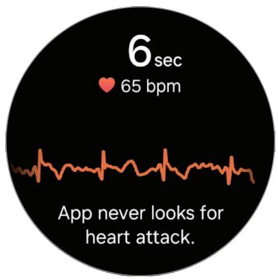 SAMSUNG SML500NZWAXEF - Mesurer l'ECG - 2