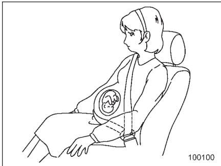 SUBARU WRX (2011) - Femmes enceintes - 1