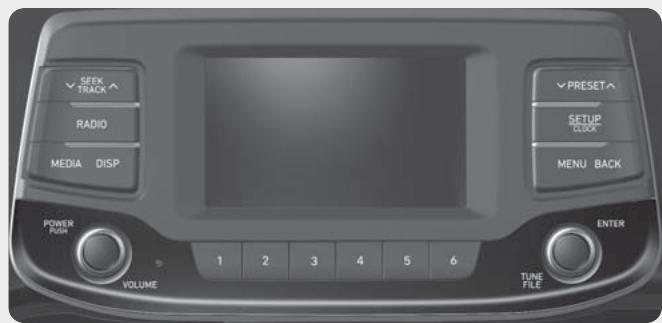 HYUNDAI i30 PD - 3 (2017-2020) - SYSTEME AUDIO (SANS ÉCRAN TACTILE) - 2