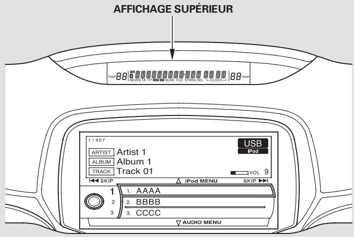 Acura RL (2011) - Lecture d'un iPod® - 1