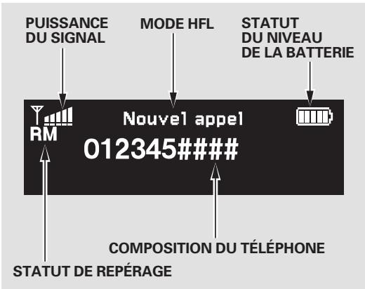 Acura RL (2011) - Affichage d'information - 1