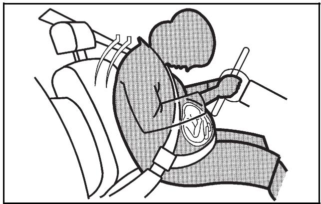 CADILLAC STS (2011) - Utilisation de la ceinture de sécurité pendant la grossesse - 1