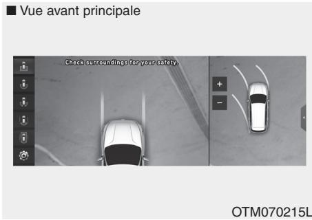 HYUNDAI Palisade (2018-2022) - Guidage de stationnement en vue de dessus - 1