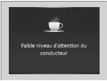 Acura TLX (2022) - Systeme de surveillance de l'attention du conducteur - 1