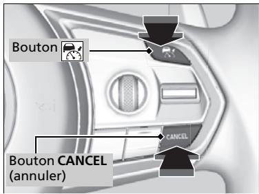 Acura TLX (2022) - Pour annuler - 1