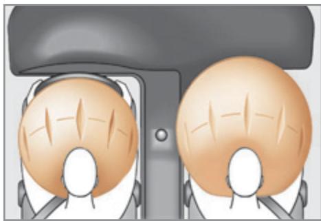 PEUGEOT 308 CC Phase 2 (2011-2015) - Airbags frontaux - 1