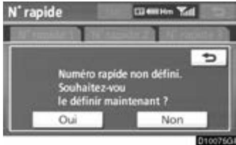 TOYOTA Venza (2010) - — Paramétrage des numérios de composition abrégée - 11