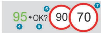 PEUGEOT 3008 (2024) - Sans preconisation anticipée de vitesse de consigne - 1