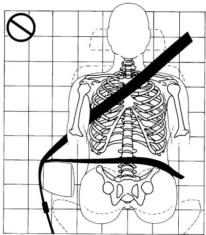 Buick Lacrosse 1 (2004-2009) - Q: Quel est le problème? - 1