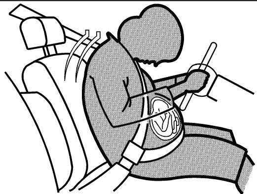 Buick Lacrosse 1 (2004-2009) - Utilisation de la ceinture de sécurité pendant la grossesse - 1
