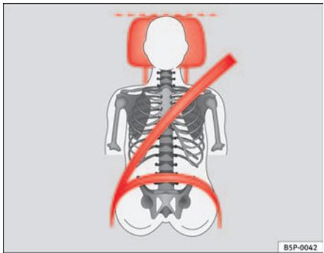 SEAT Cordoba (2002-2009) - Réglage correct des appuie-têtes - 1
