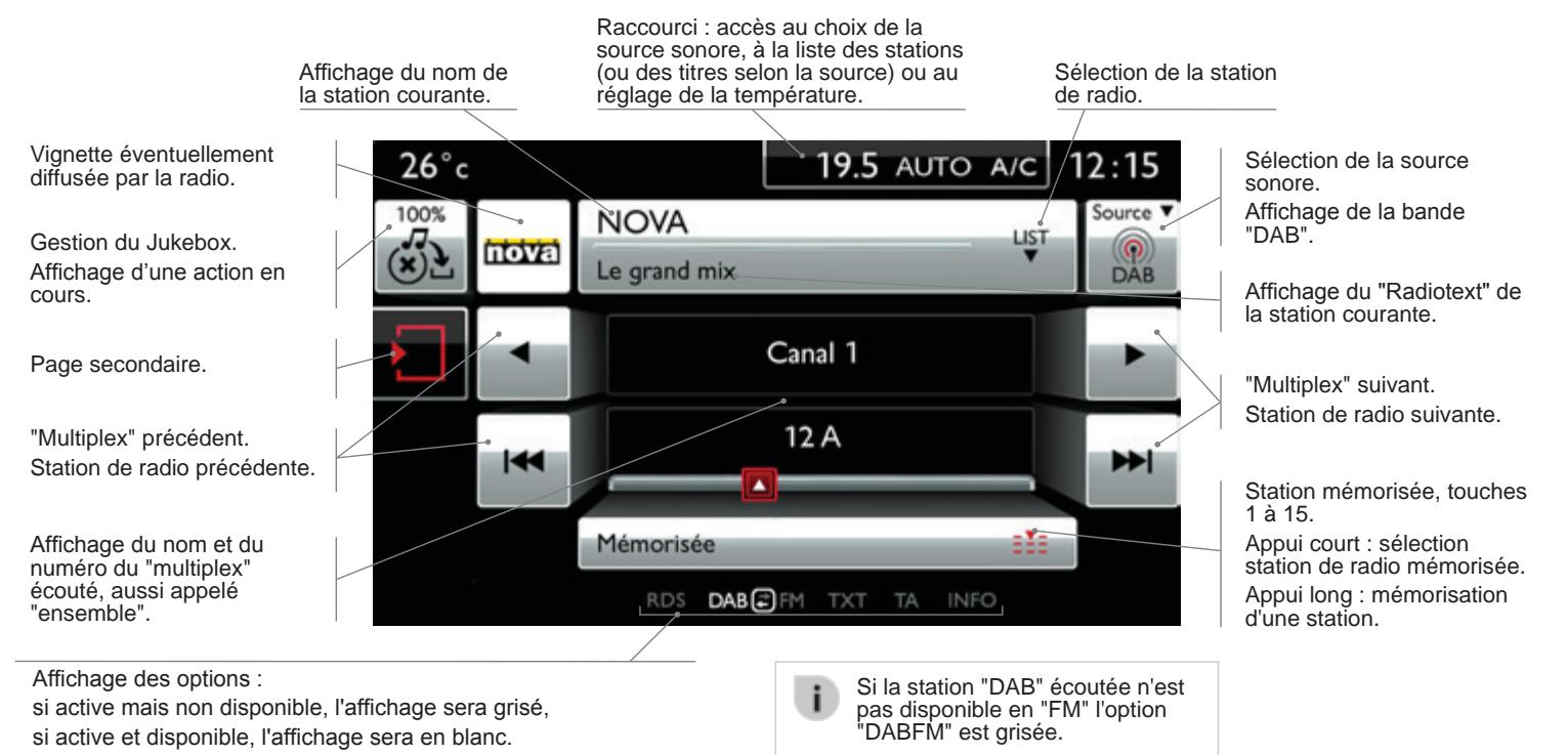 CITROEN C4 Cactus (2015-2018) - RADIO - 1
