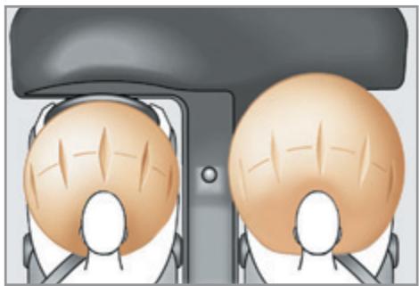 PEUGEOT 207 CC Phase 3 (2012-2015) - Airbags frontaux - 1