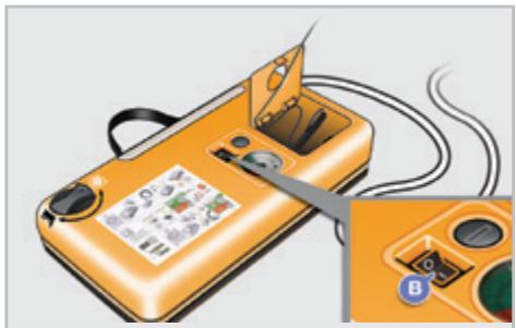 PEUGEOT 207 CC Phase 3 (2012-2015) - Colmatage - 5