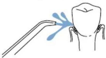 Waterpik Nano Traveler WP300 - Soins bucco-dentaires avec l'hydropropulseur Waterpik® - 1