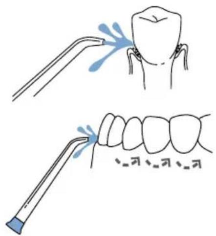Waterpik Nano Traveler WP300 - Technique recommandée - 1