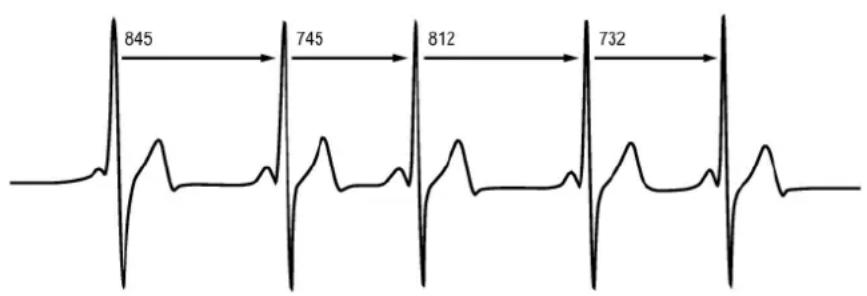 POLAR RC3 GPS - Variabilité de la fréquence cardiaque - 1