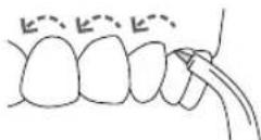 Waterpik WP450 - Embout Pik Pocket - 2