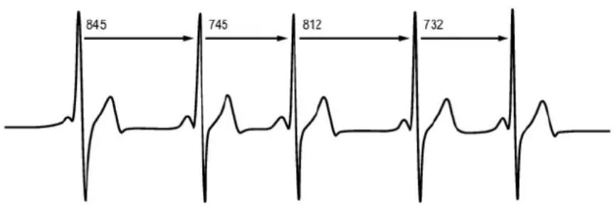 POLAR RS800CX - Variabilité de la fréquence cardiaque - 1