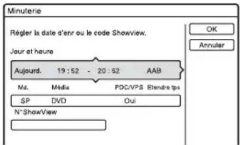 SONY RDRHX722 - Appuyez sur TIMER. - 1