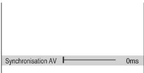 Synchronisation AV ———— 0ms