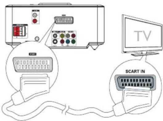 PHILIPS MCD712 - Anschließen der Videokabel - 1
