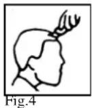 TRISTAR TR2547 - KAMMAUFSÄTZE - 6