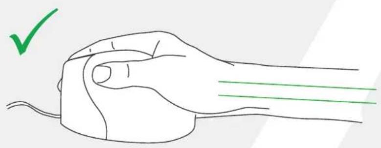 BakkerElkhuizen Evoluent4 - 2