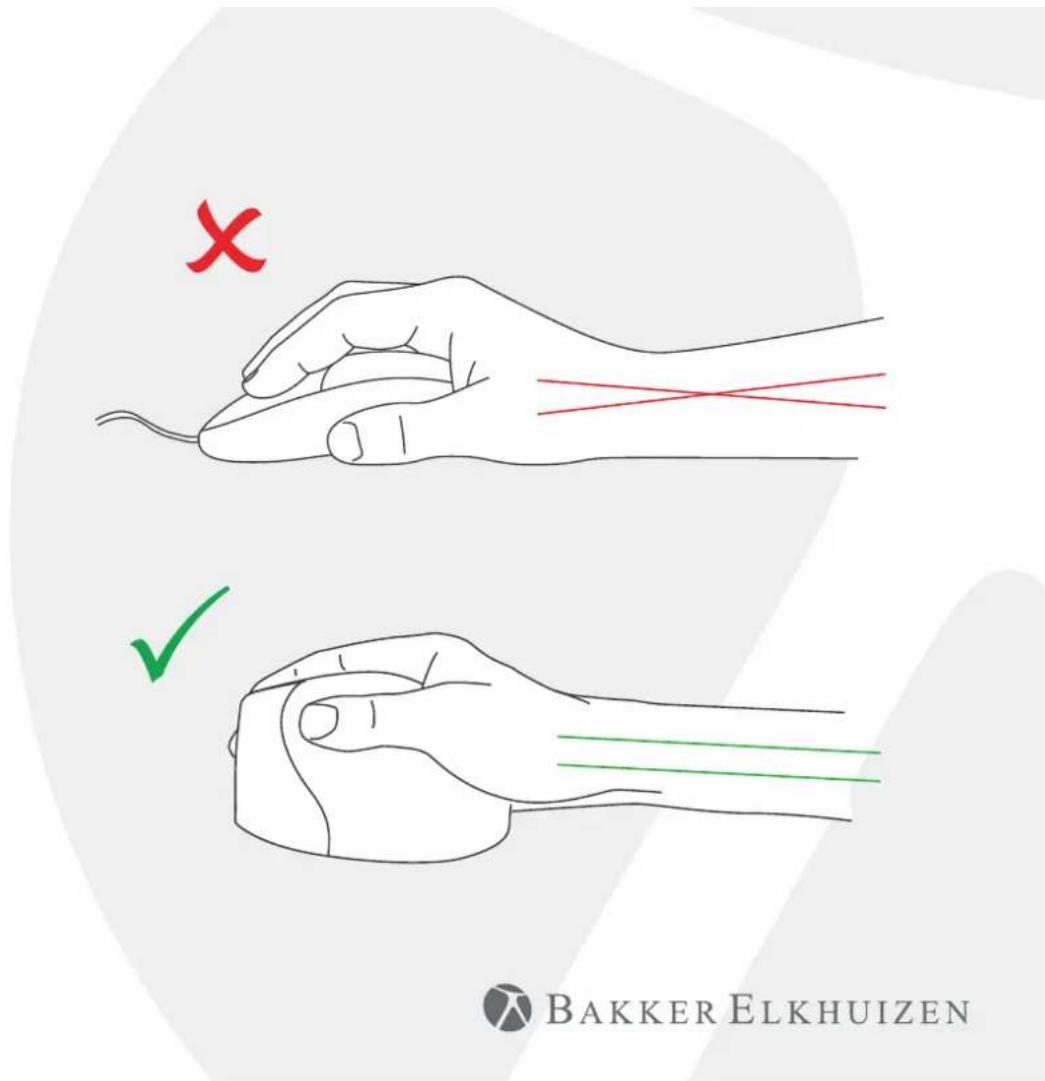 BakkerElkhuizen Evoluent4 Wireless - 1